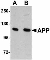 APP / Beta Amyloid Precursor Antibody