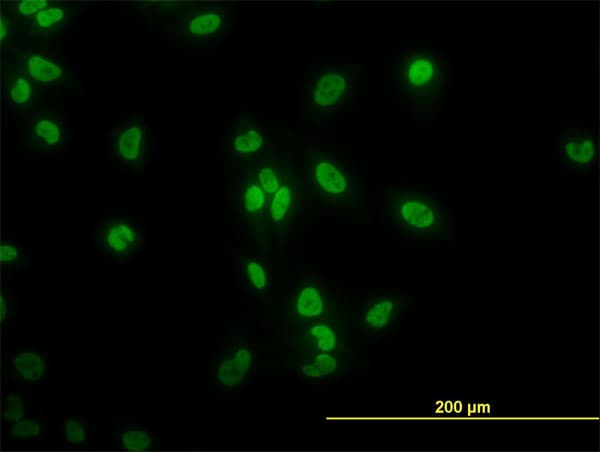TAF11 Antibody (clone 3G6)