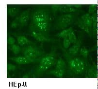 PML Antibody (clone 1B9)