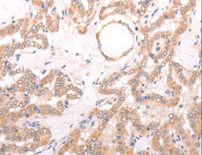 TRPV4 Antibody