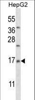 Polyclonal Rabbit anti-Human MRPL33 Antibody (aa36-65, IHC, WB)