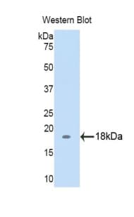 BGN / Biglycan Antibody (aa230-366)