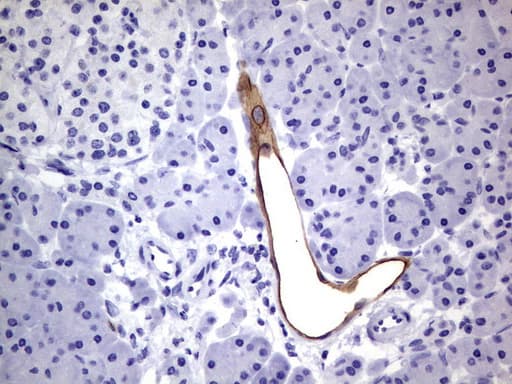 MAdCAM-1 Antibody (clone UMAB158)