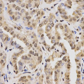 Polyclonal Rabbit anti-Human Histone H3 Antibody (Methyl-Lys27, IHC, IF, WB)