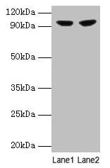IHC-plus™ PYGL Antibody