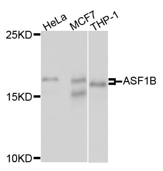 Polyclonal Rabbit anti-Human ASF1B Antibody (WB)