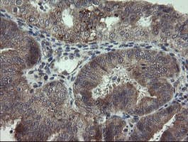ARL2BP / BART Antibody (clone OTI1A10)