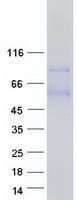 Human PRELP / Prolargin Protein (Recombinant Myc-DDK (Flag))