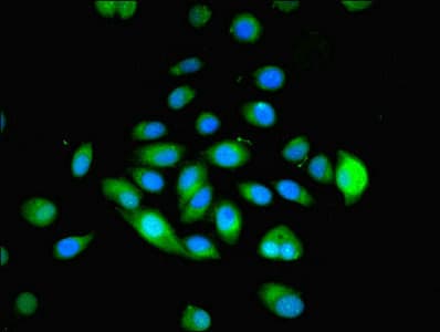 MYADM / Myeloid Marker BM-1 Antibody