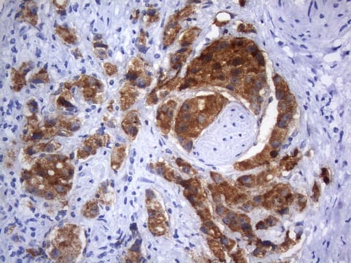 AMACR / P504S Antibody (clone UMAB214)