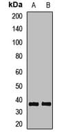 DNASE1 / DNase I Antibody