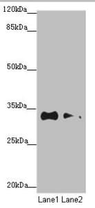 TNRC5 / CNPY3 Antibody