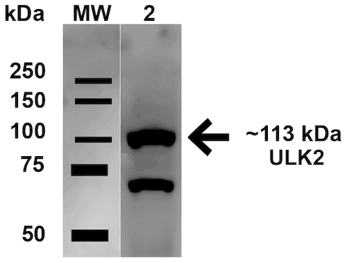 ULK2 Antibody (RPE)