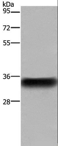 FCGR2 / CD32 Antibody