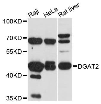 DGAT2 Antibody