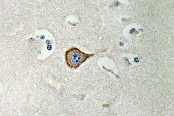 Polyclonal Rabbit anti-Human CNPase Antibody (Ala108, IHC, WB)