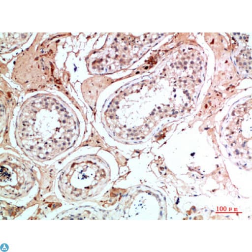 Polyclonal Rabbit anti-Human NANOS1 / NOS1 Antibody (WB)