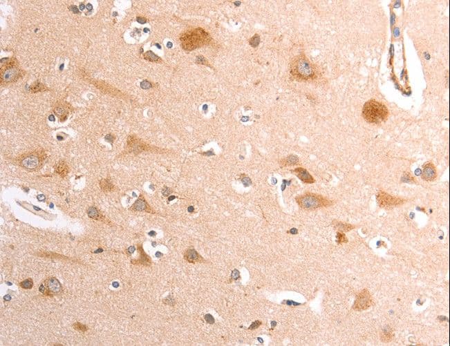 TRPV4 Antibody
