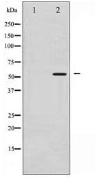 p56lck / LCK Antibody