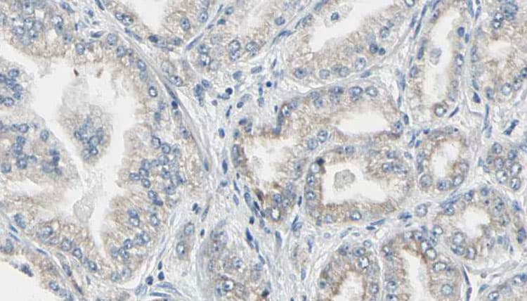 FTL / Ferritin Light Chain Antibody