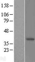 NMI Protein (Over-Expression Lysate Myc-DDK (Flag))