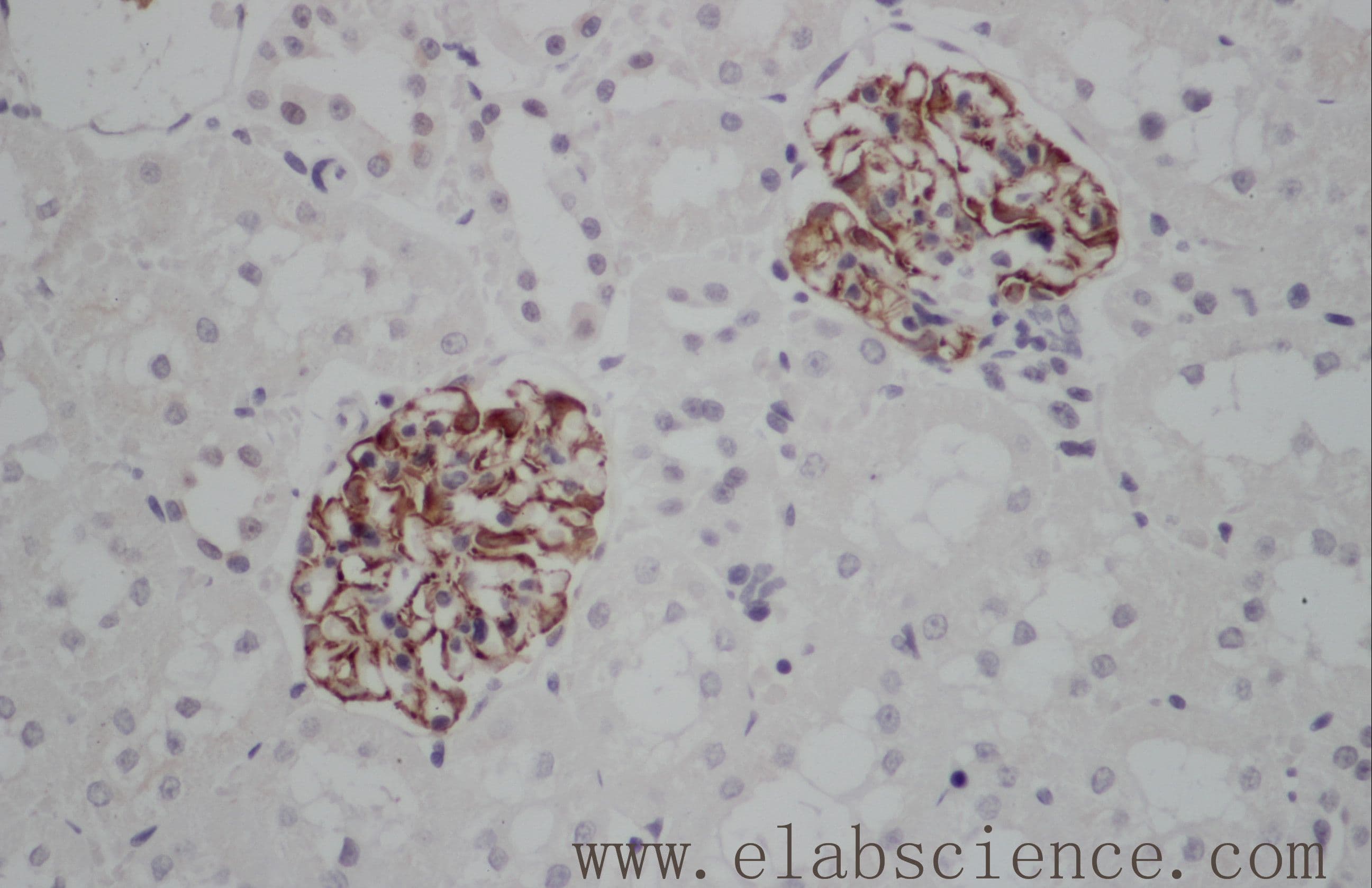 Polyclonal Rabbit anti-Human NES / Nestin Antibody (IHC)