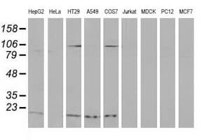 DSTN / Destrin Antibody (clone OTI2E8, Carrier-free)
