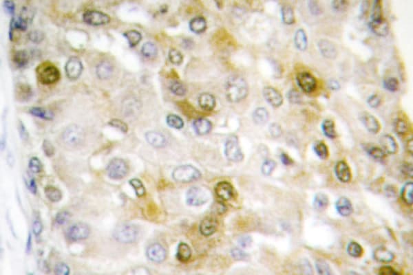 Polyclonal Rabbit anti-Human CTNNB1 / Beta Catenin Antibody (Gly650, IHC, IF, WB)