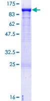 Human KIF3A Protein (Recombinant GST)