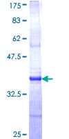 Human CTNS / Cystinosin Protein (Recombinant GST, N-terminus)