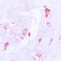 CSRNP2 / FAM130A1 Antibody (Internal)