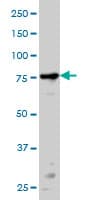 PRKCA / PKC-Alpha Antibody (clone 2F11)