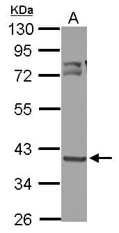Polyclonal Rabbit anti-Human OXSM / KS Antibody (IHC, WB)