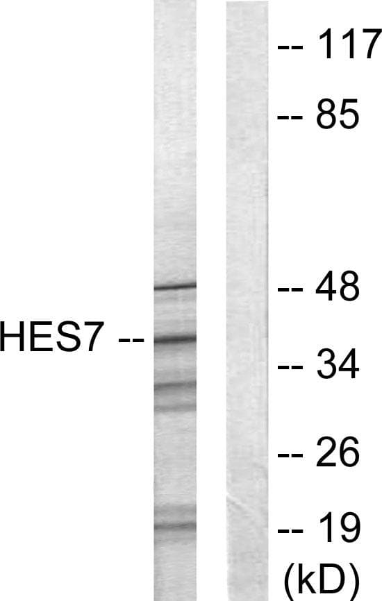 Polyclonal Rabbit anti-Human HEXIM1 Antibody (IF, WB)