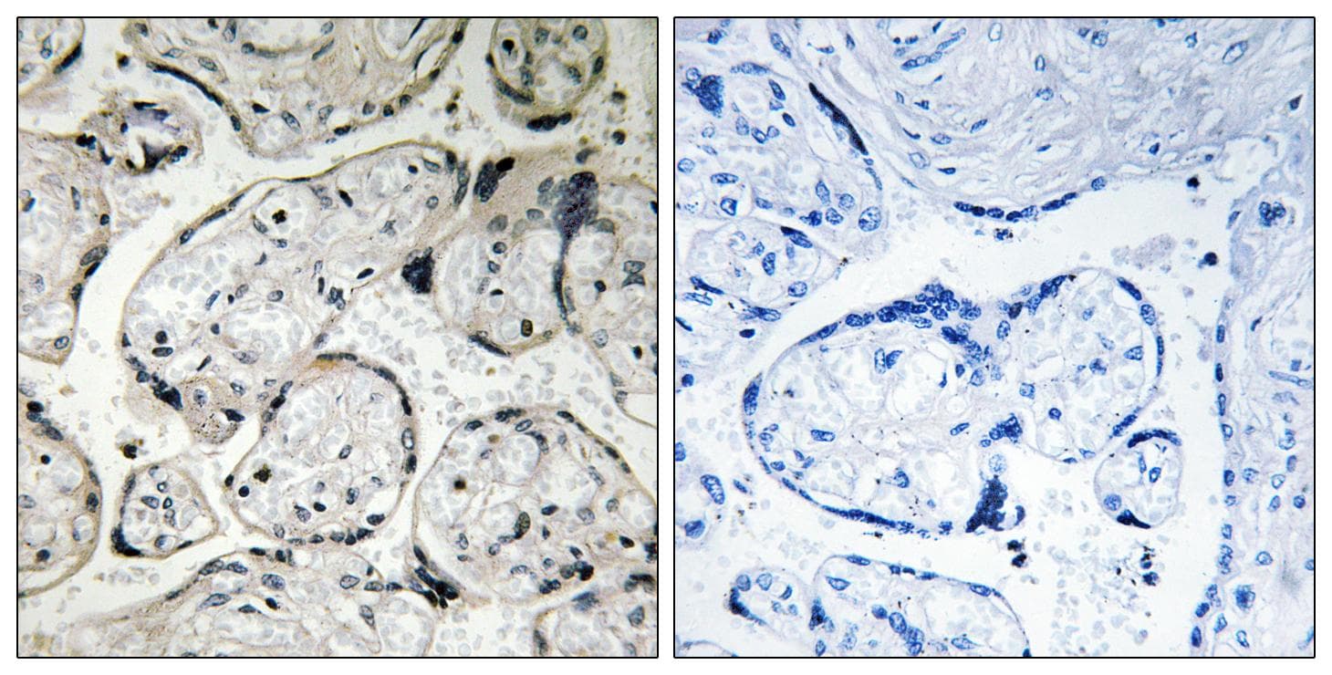 Polyclonal Rabbit anti-Human CYB5R3 / B5R Antibody (IHC, WB)