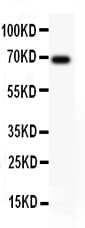 Alpha-Fetoprotein Antibody (aa378-609)