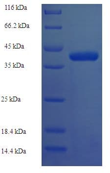 Human DNTTIP1 / TDIF1 Protein (Recombinant His)
