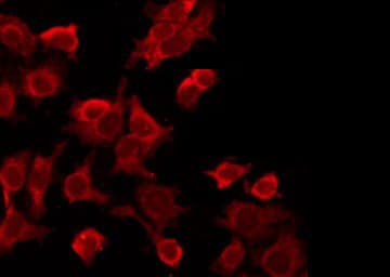 LTBR Antibody