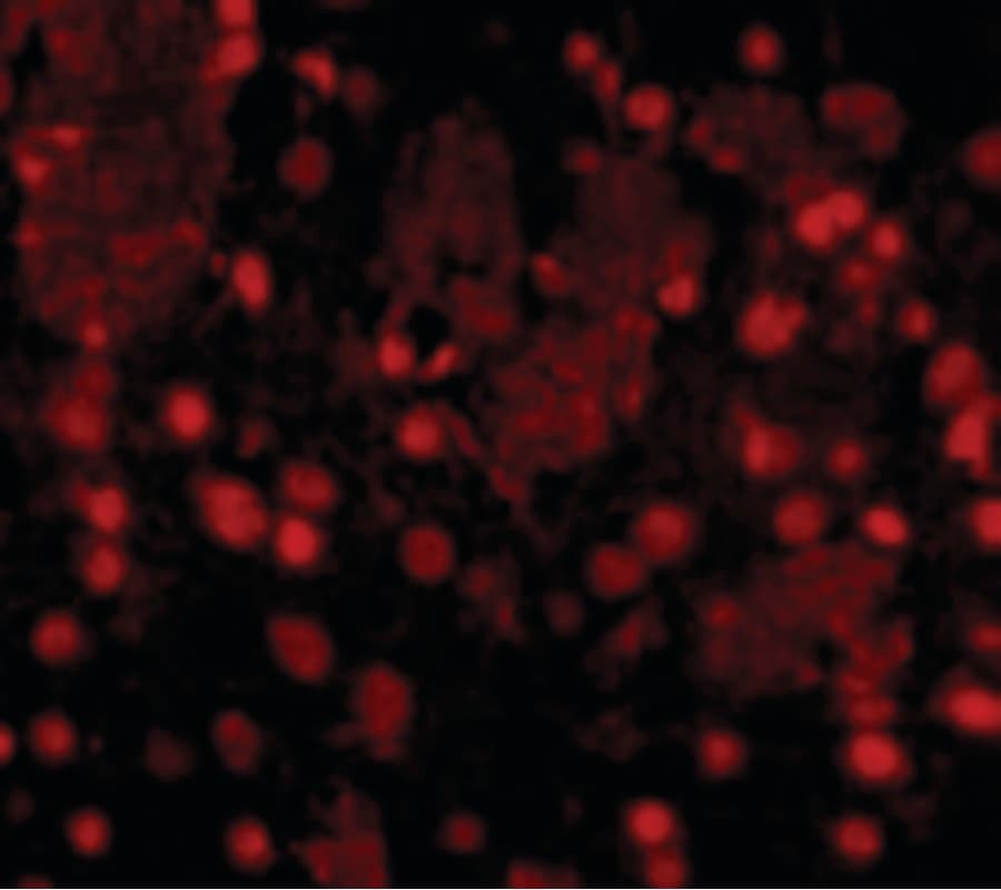 FTO Antibody
