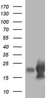LYZ / Lysozyme Antibody (clone OTI2C2)