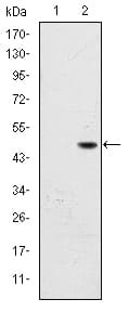 IHC-plus™ FAC1 / BPTF Antibody (clone 2F10)