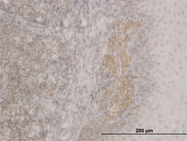 Monoclonal Mouse anti-Human FOXO3 / FOXO3A Antibody (clone 2C4, IHC, IF, WB)