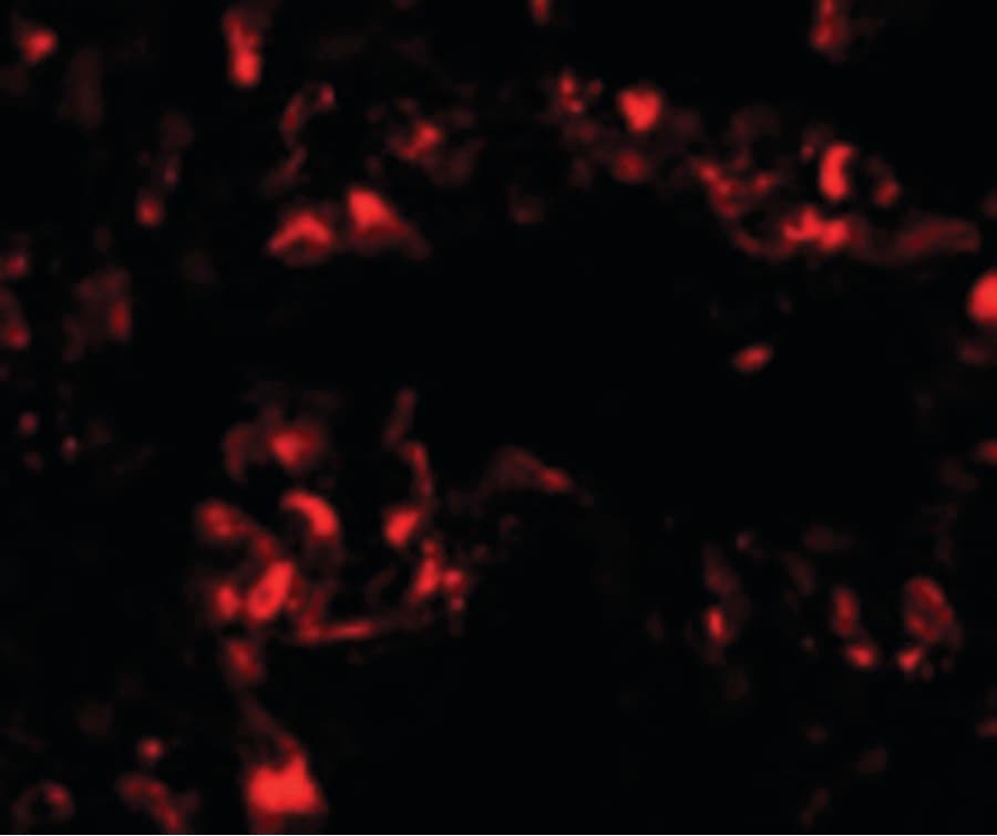 FOXRED2 Antibody