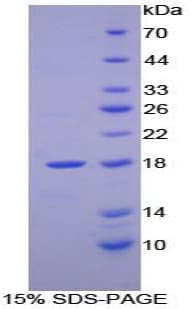 Human RBP2 / CRBPII Protein (Recombinant His)