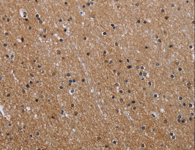 GAB2 Antibody