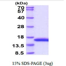 Human FABP1 / L-FABP Protein (Recombinant His)
