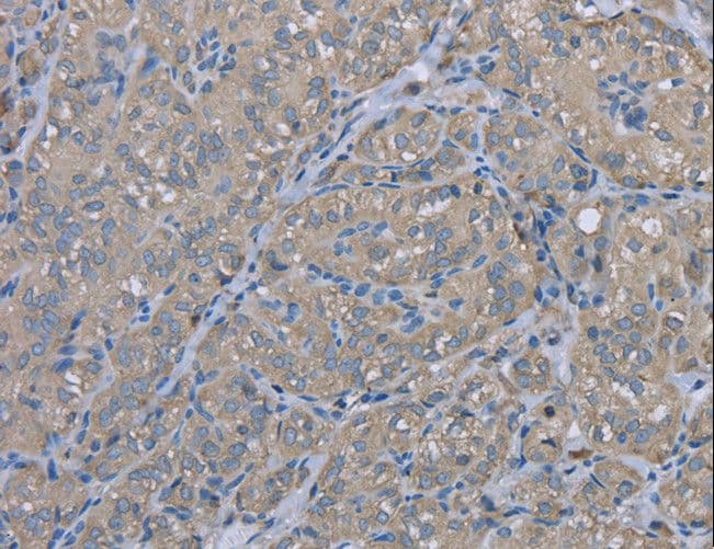 Polyclonal Rabbit anti-Human EZR / Ezrin Antibody (IHC, WB)