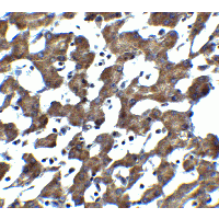 IL1RL1 Antibody
