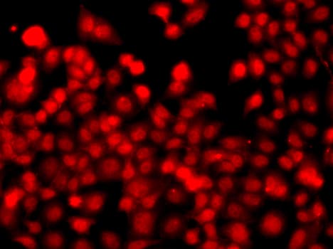 THAP1 Antibody (AP)