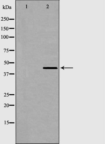 Polyclonal Rabbit anti-Human AURKA / Aurora-A Antibody (IF, WB)